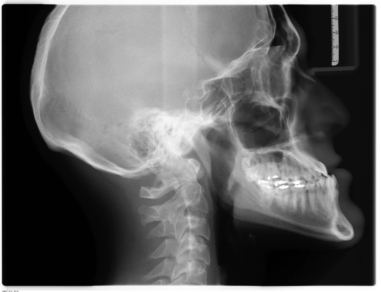 Radiologist interpreting diagnostic images on a screen